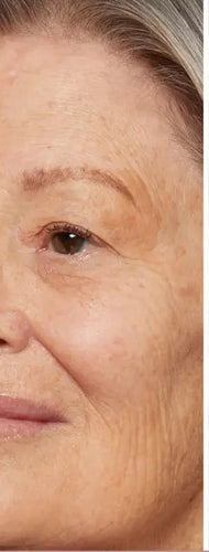 After application